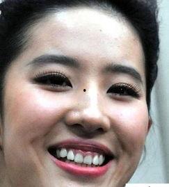 牙花子图片,揭秘口腔健康的秘密花园